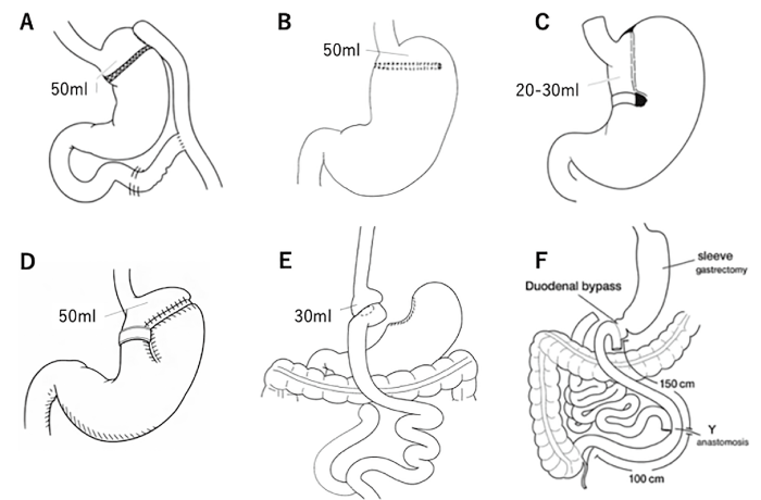 Fig.1