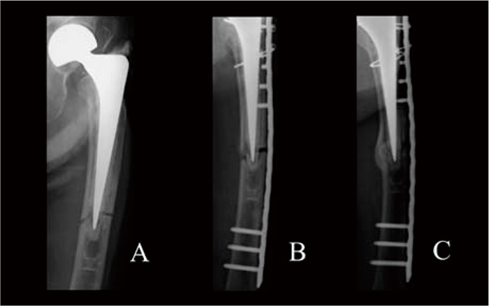 Fig.1