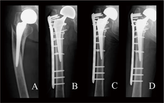 Fig.2