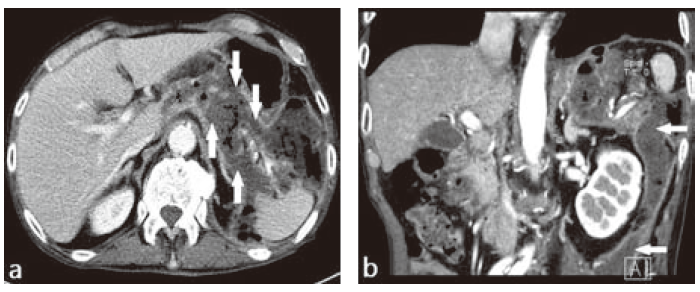 Fig.1