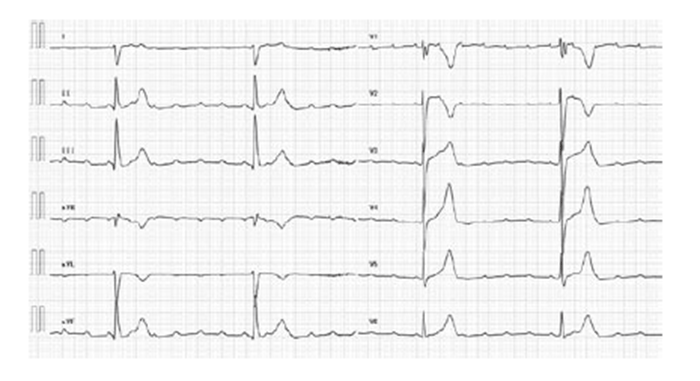 Fig. 1