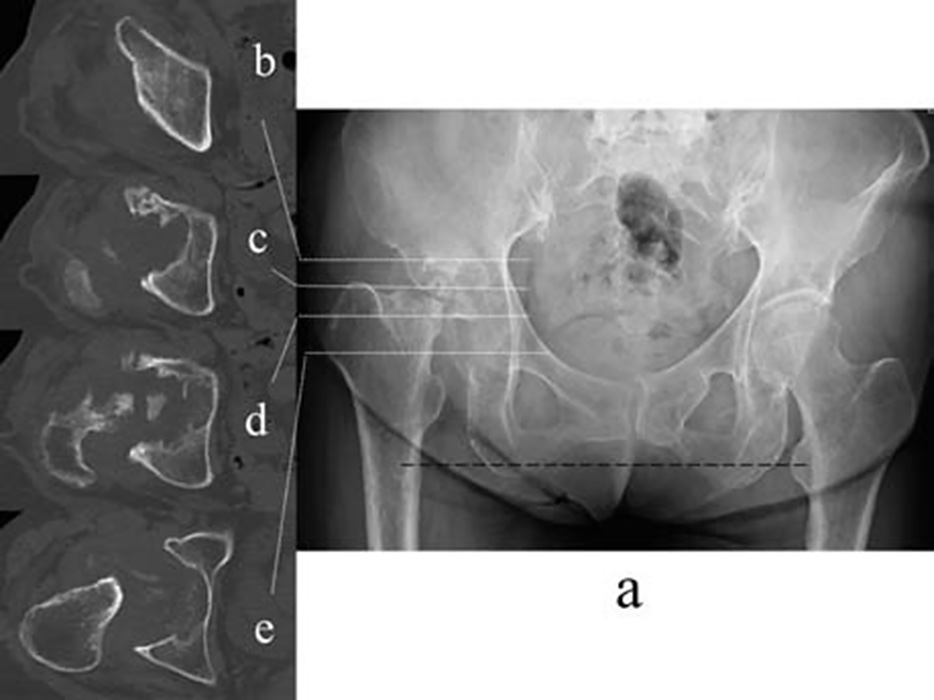 Fig. 1