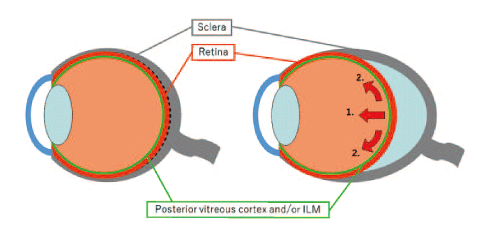 Fig. 2