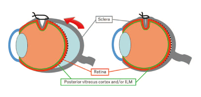 Fig. 5