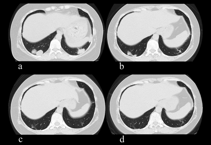 Fig. 2