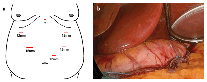 Fig. 2a