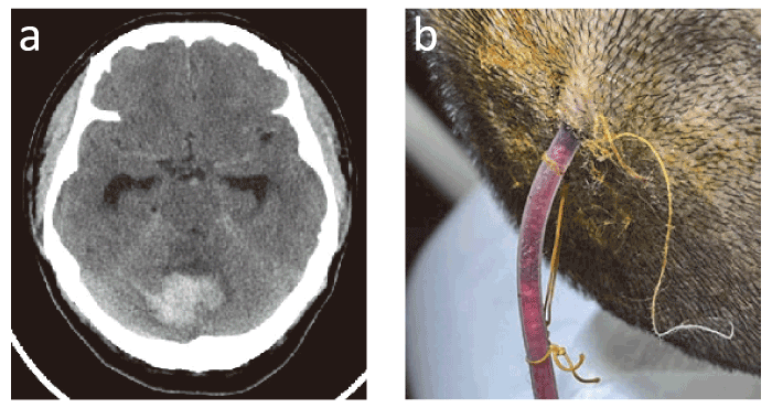 Fig. 1