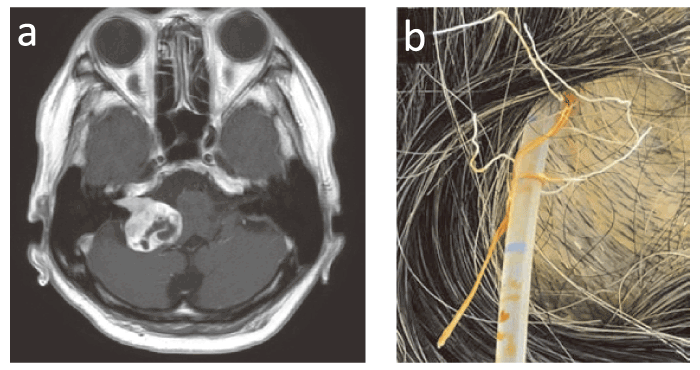 Fig. 3