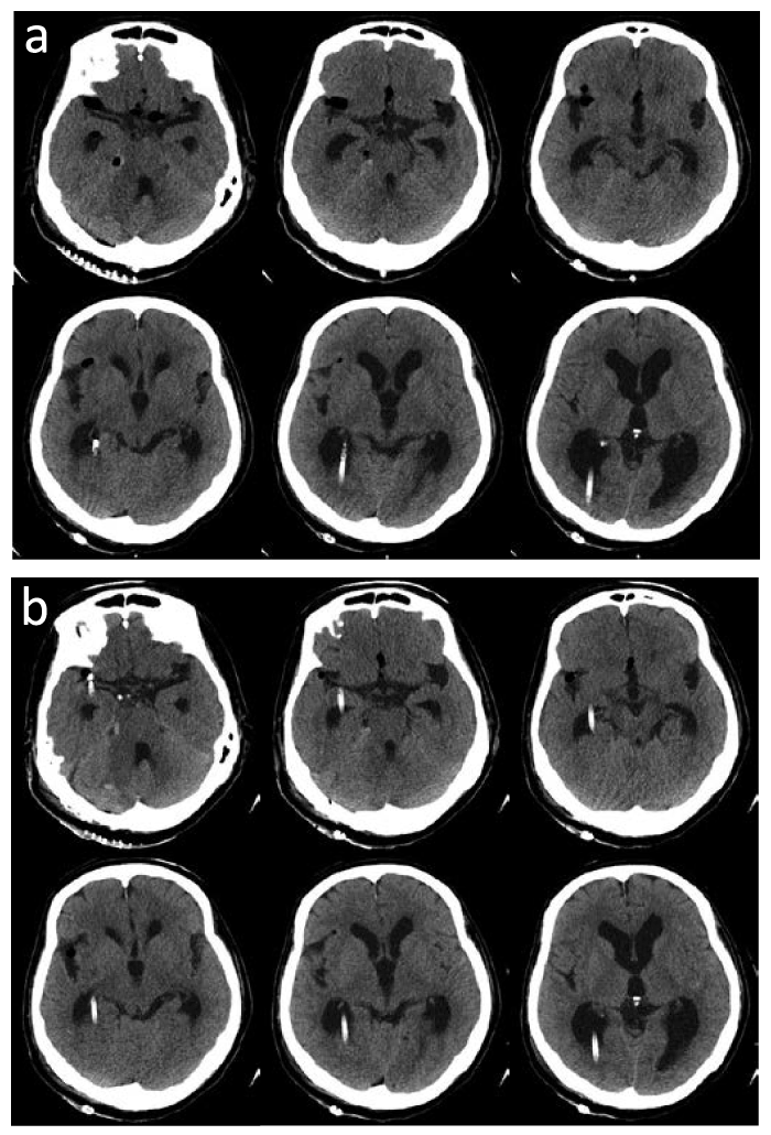 Fig. 4