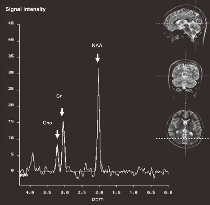 Fig.1