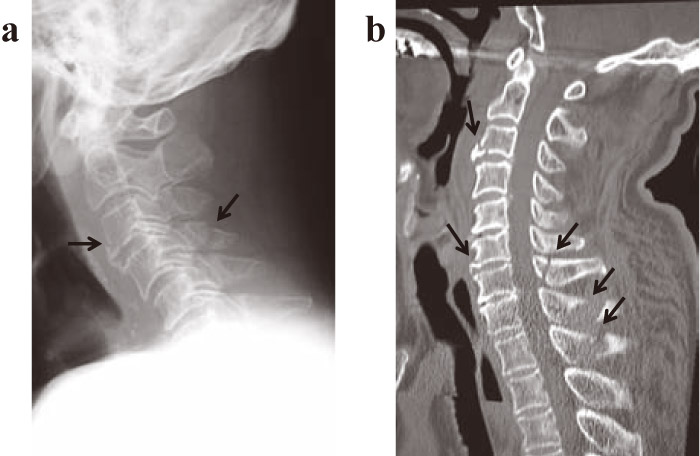 Fig.1