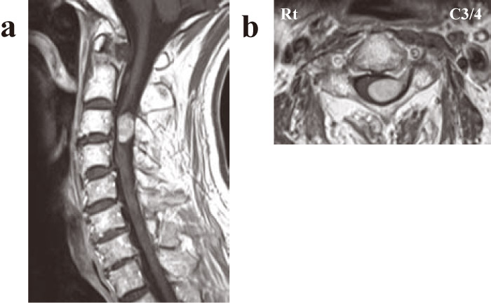 Fig.3