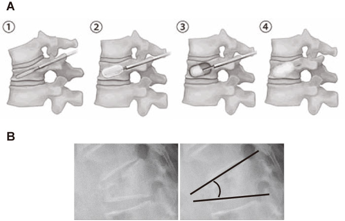 Fig.1