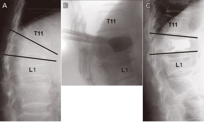 Fig.2