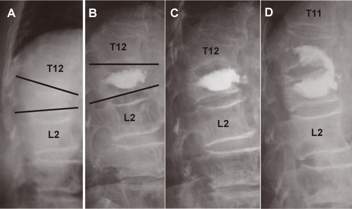 Fig.3