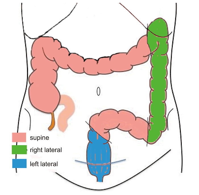 Fig.1