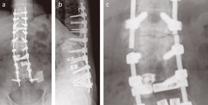 Fig.1