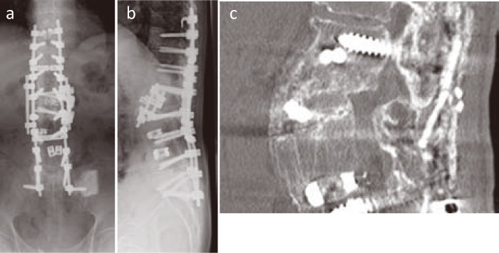 Fig.4