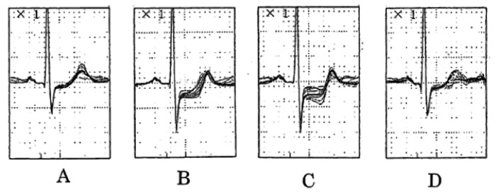 Fig.1