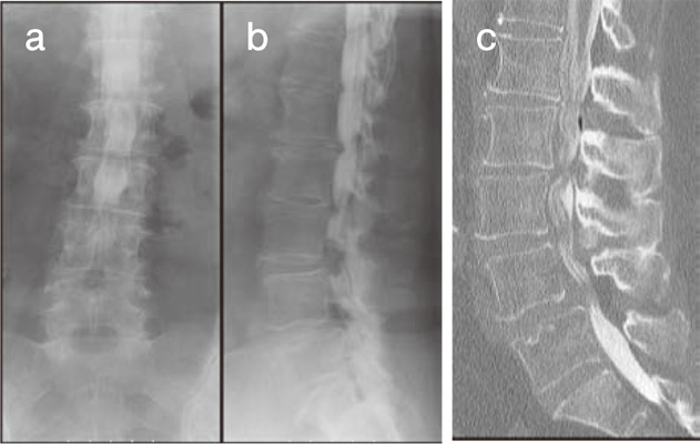 Fig.2