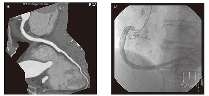 Fig.1