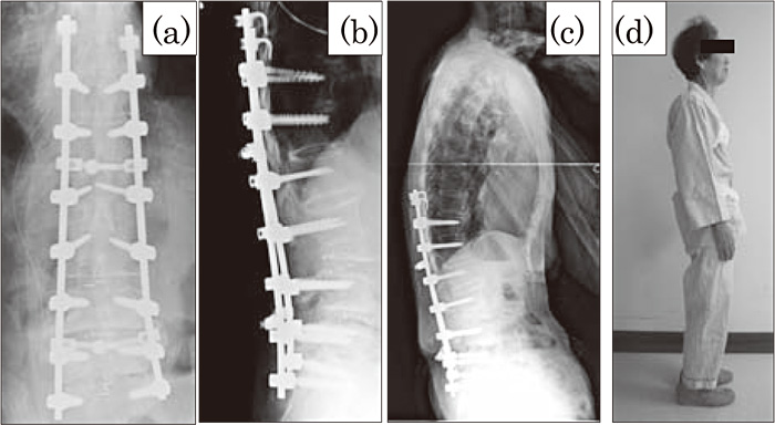 Fig.4