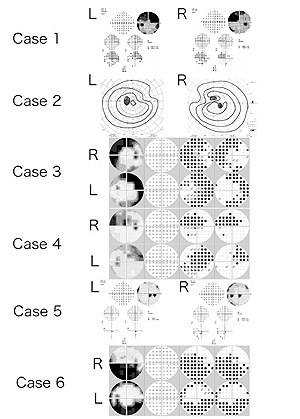Fig.1