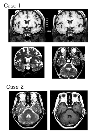Fig.2