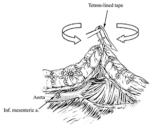 Fig.2