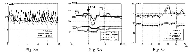 Fig.3
