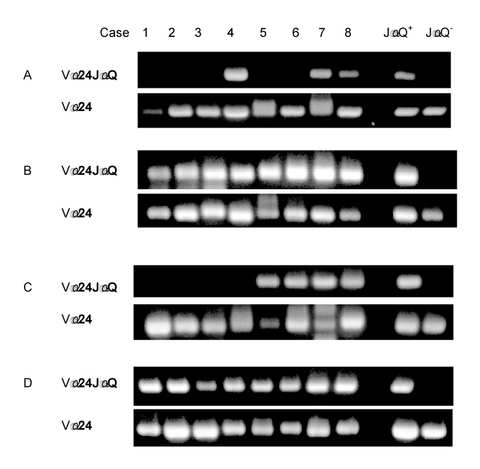 Fig.1