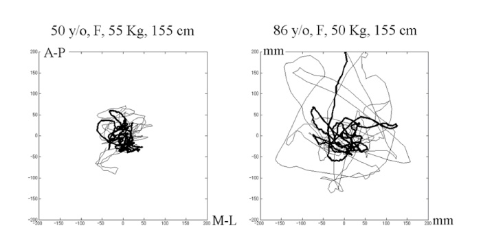 Fig.1