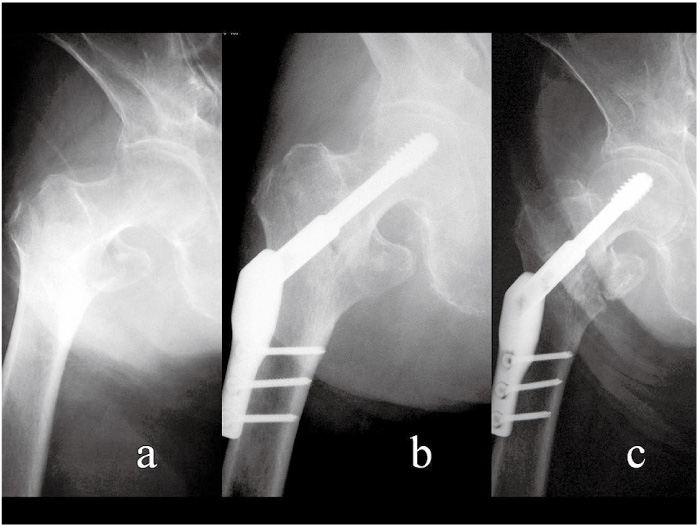 Fig. 1