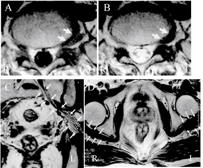 Fig.1