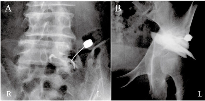 Fig.1