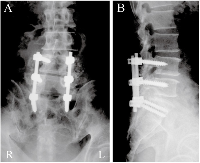 Fig.3