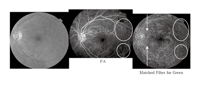 Fig.1