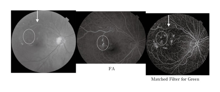 Fig.3