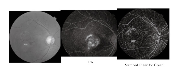 Fig.3