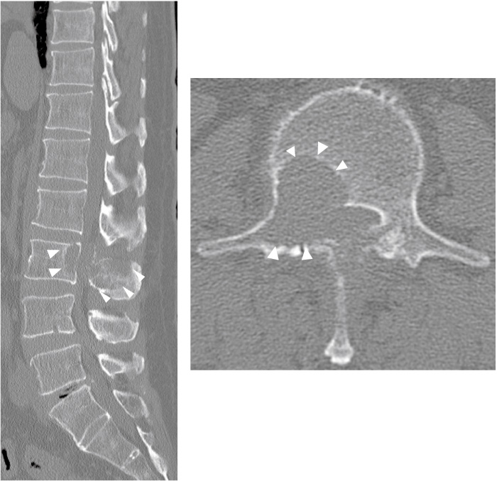 Fig.1