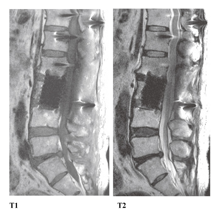 Fig.8